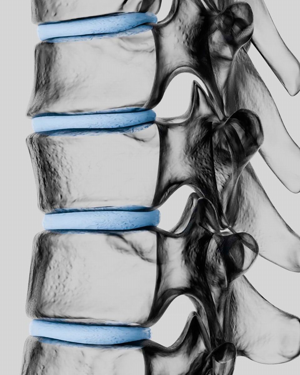 support-the-spine